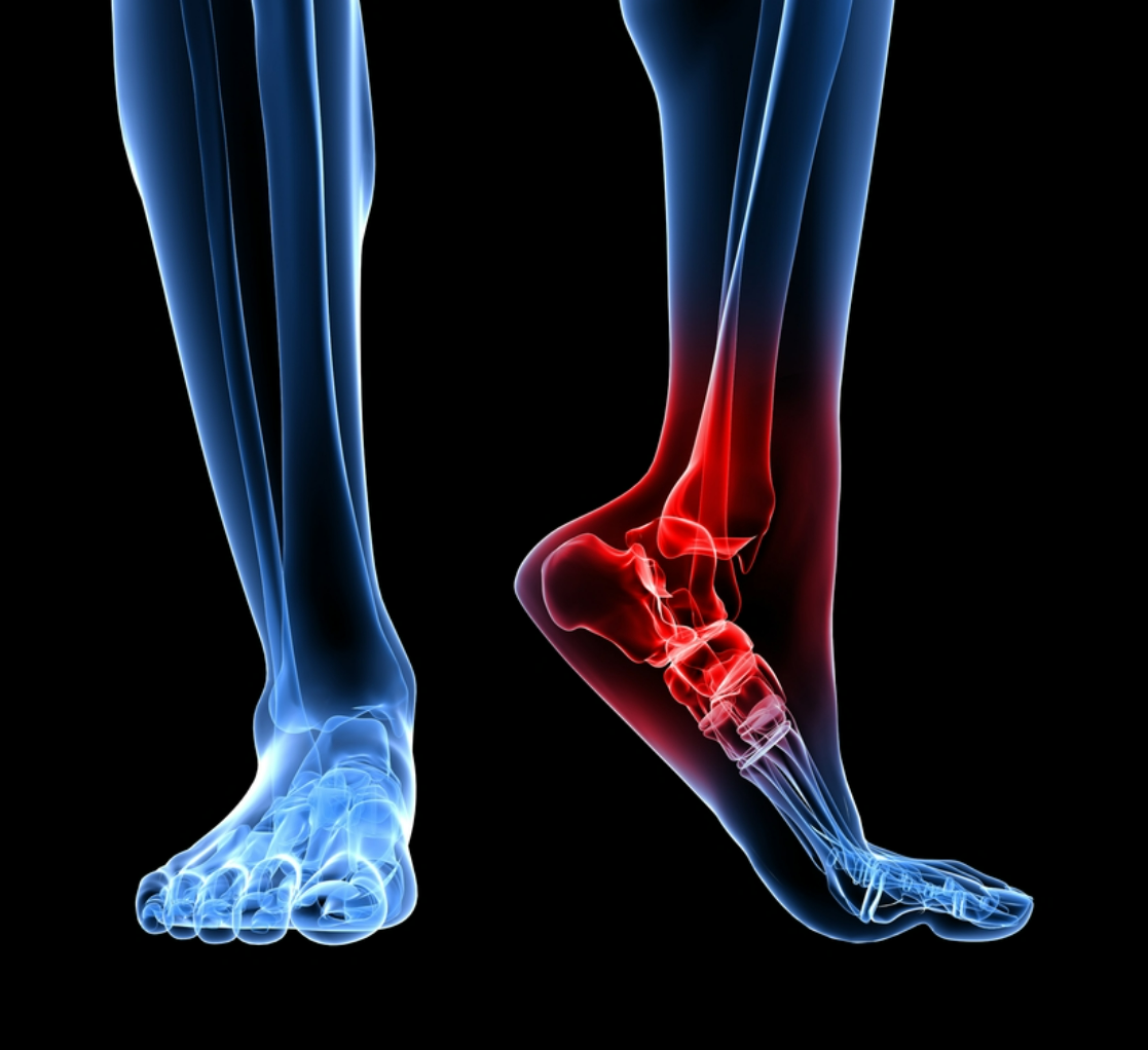 Alix | Sandales Orthopédiques D'Été Pour Femme